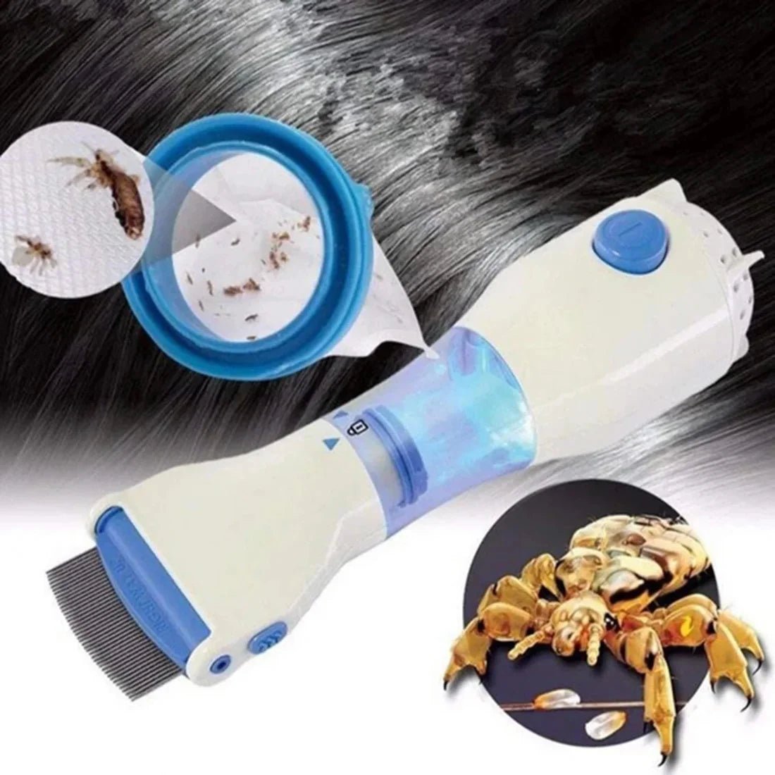 Electric V - Comb Anti Lice Machine | Chemical - Free Safe Lice & Egg Removal Device - jnty.pk